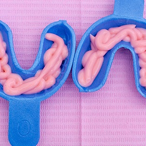 Pink fluoride foam in blue applicator trays