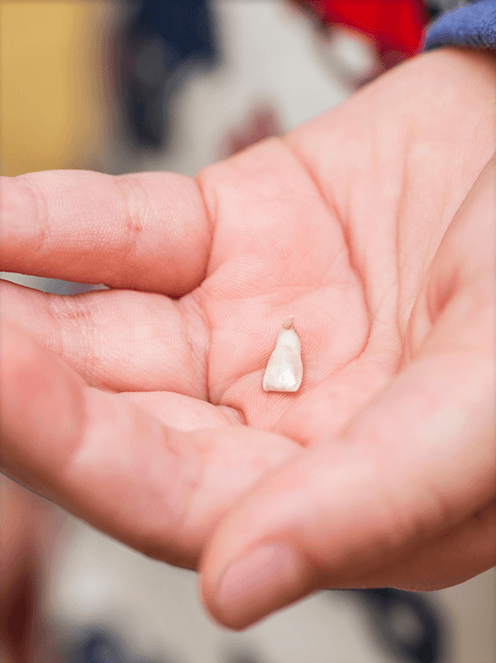 Hand holding an extracted tooth